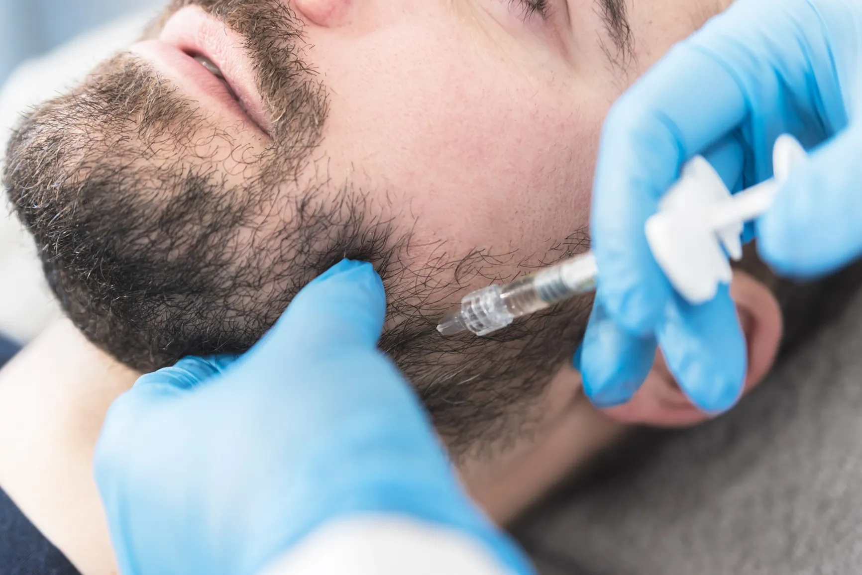 Jaw-Filler-in-Just-for-men-by-Azul-blanca-medspa-in-pine-grove-mills-pa