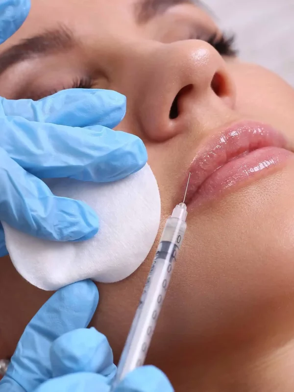 Filler-in-services-by-Azul-blanca-medspa-in-Pine-Grove-Mills-Pa.