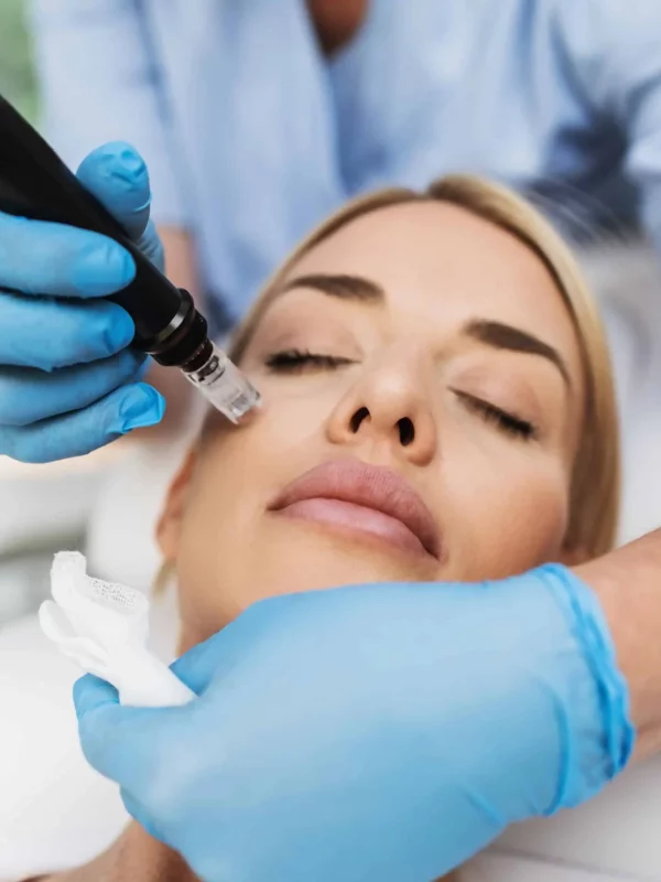 Microneedling-in-services-by-Azul-blanca-medspa-in-Pine-Grove-Mills-Pa