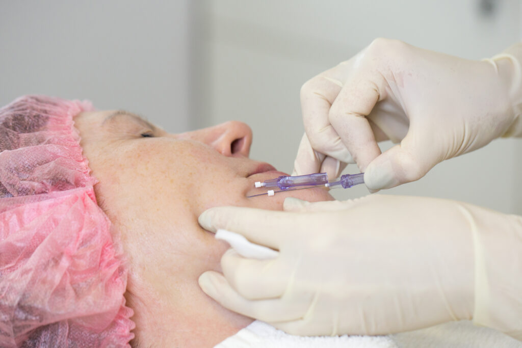 How PDO Threads Stimulate Collagen Production for Youthful Skin | Azul Blanca Med Spa in State College, PA